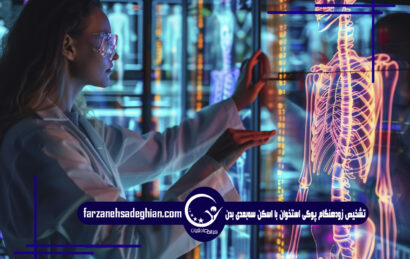 پوکی استخوان