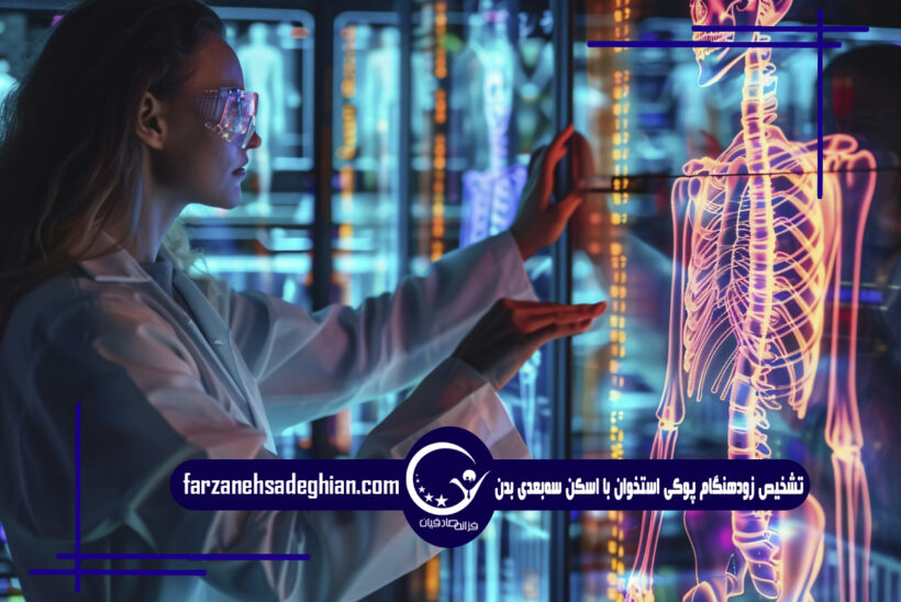 پوکی استخوان